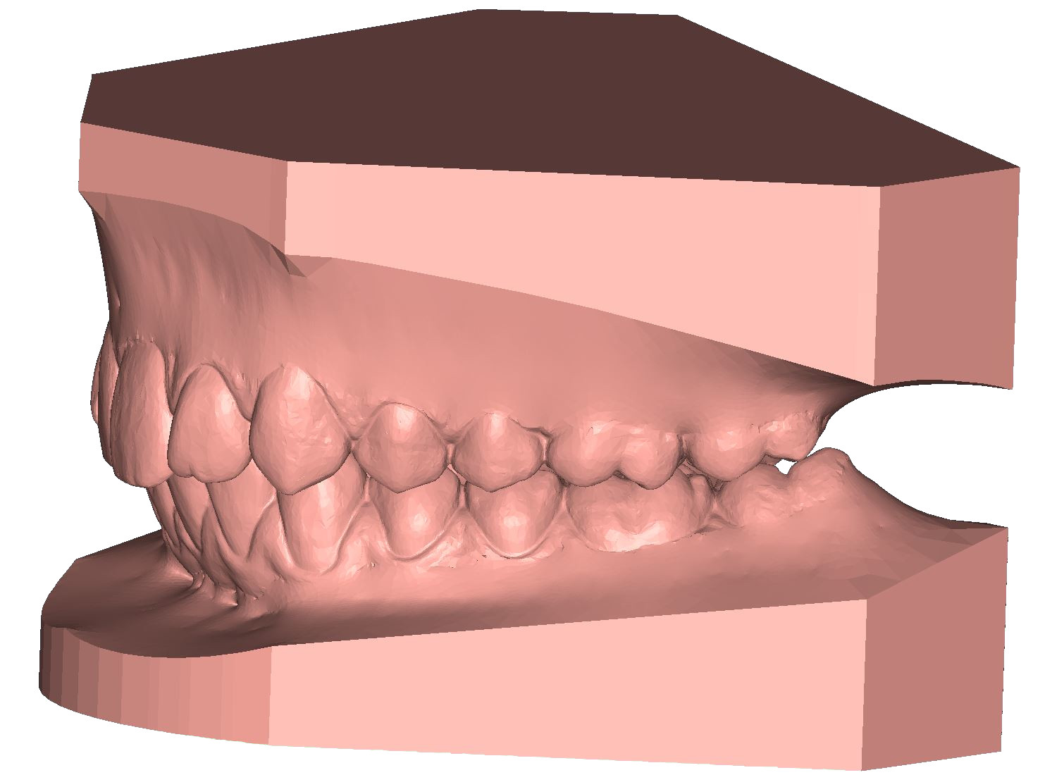 ArchBase study base 3D dental model DeltaFace