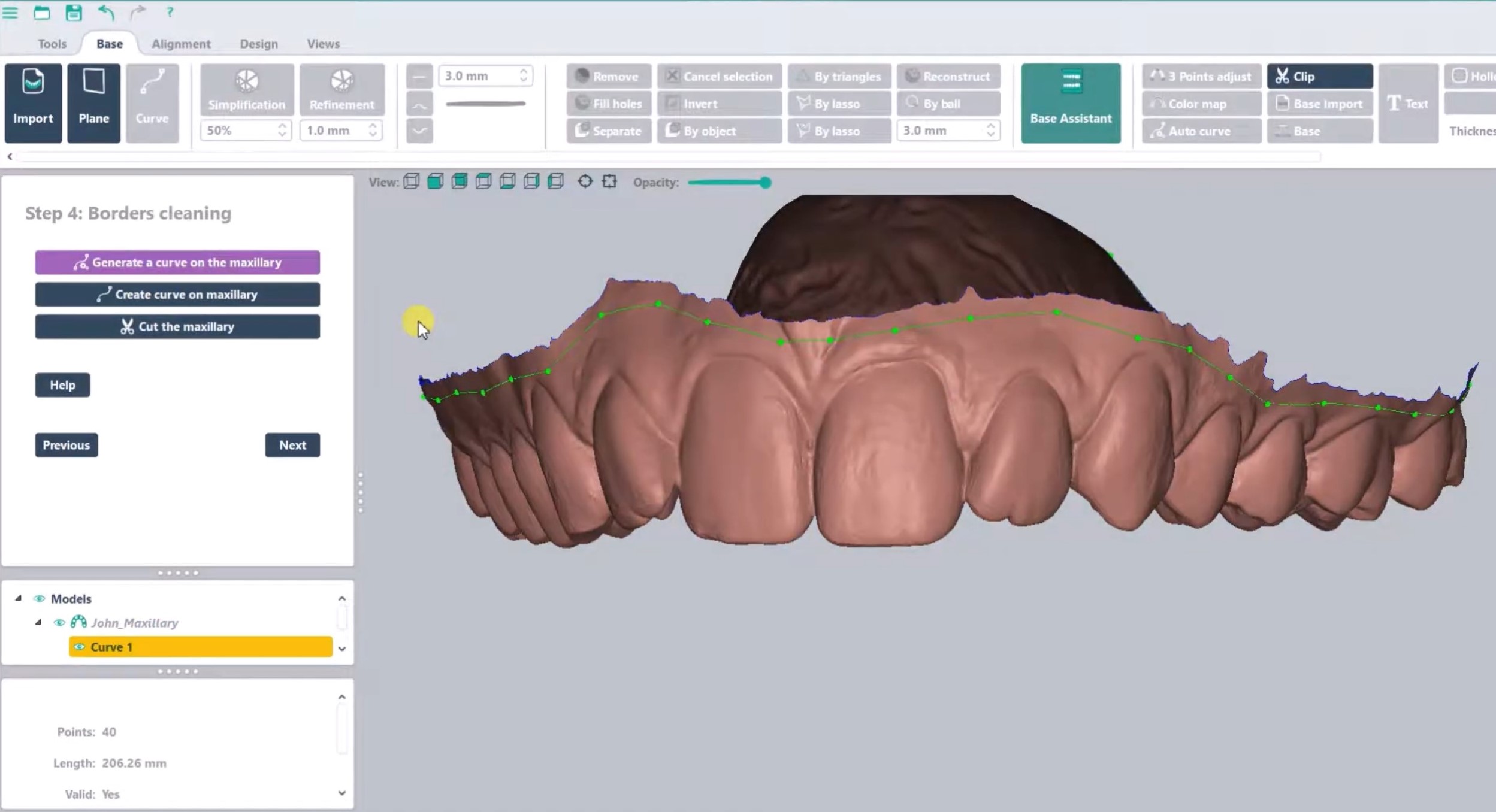 Automatic curves 3D dental model Arch Base DeltaFace