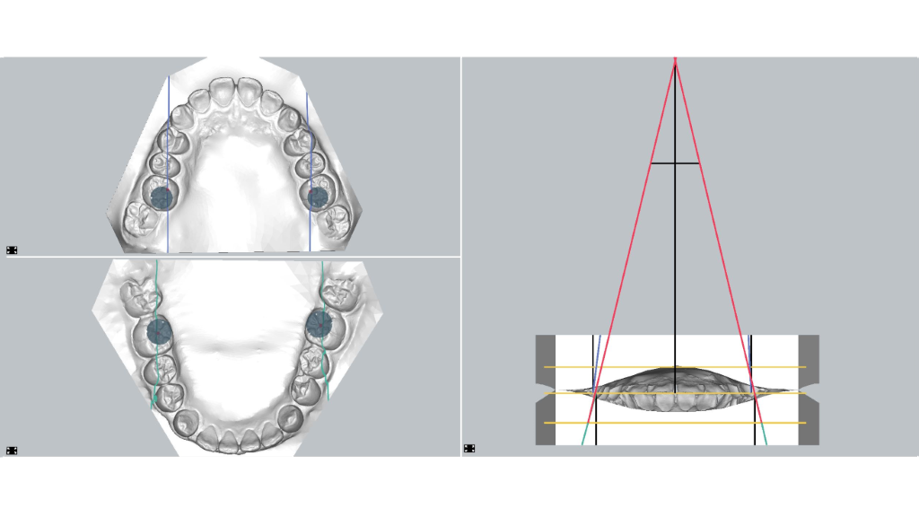 orthodontic axioscopy