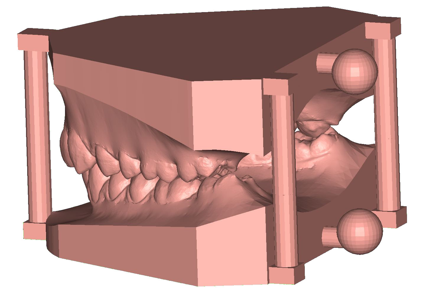 ArchBase study base tripod twister 3D dental model DeltaFace