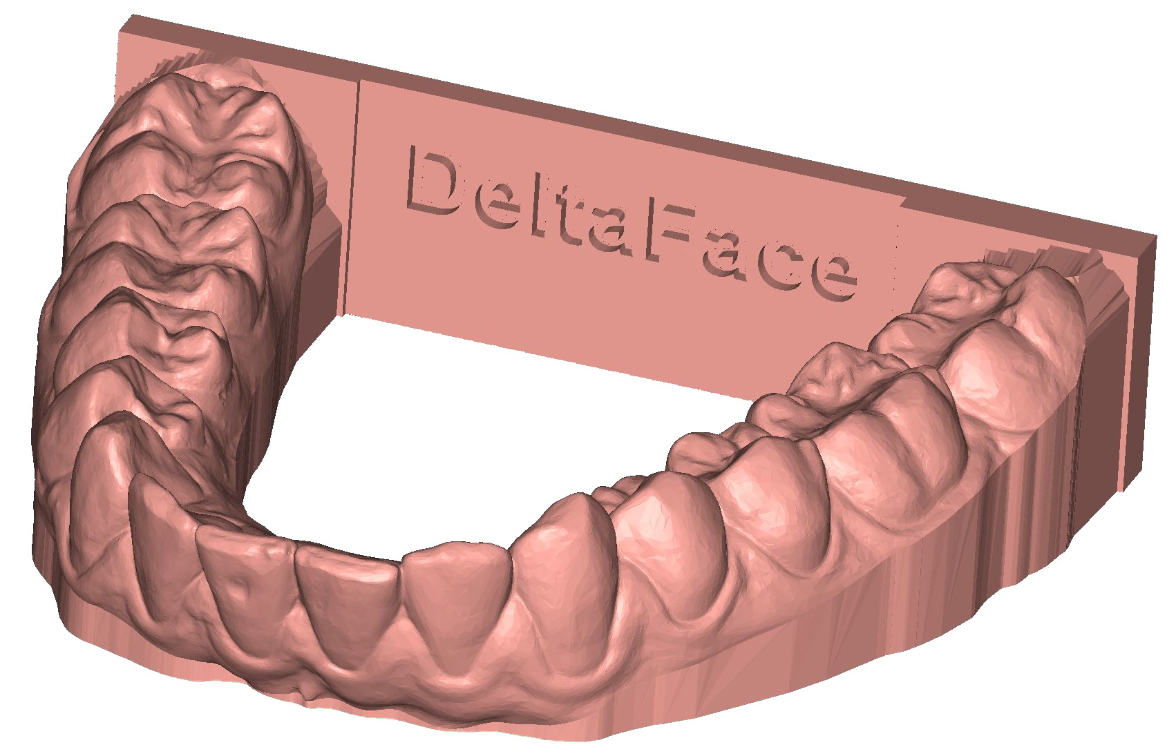 ArchBase base back plate 3D dental model DeltaFace