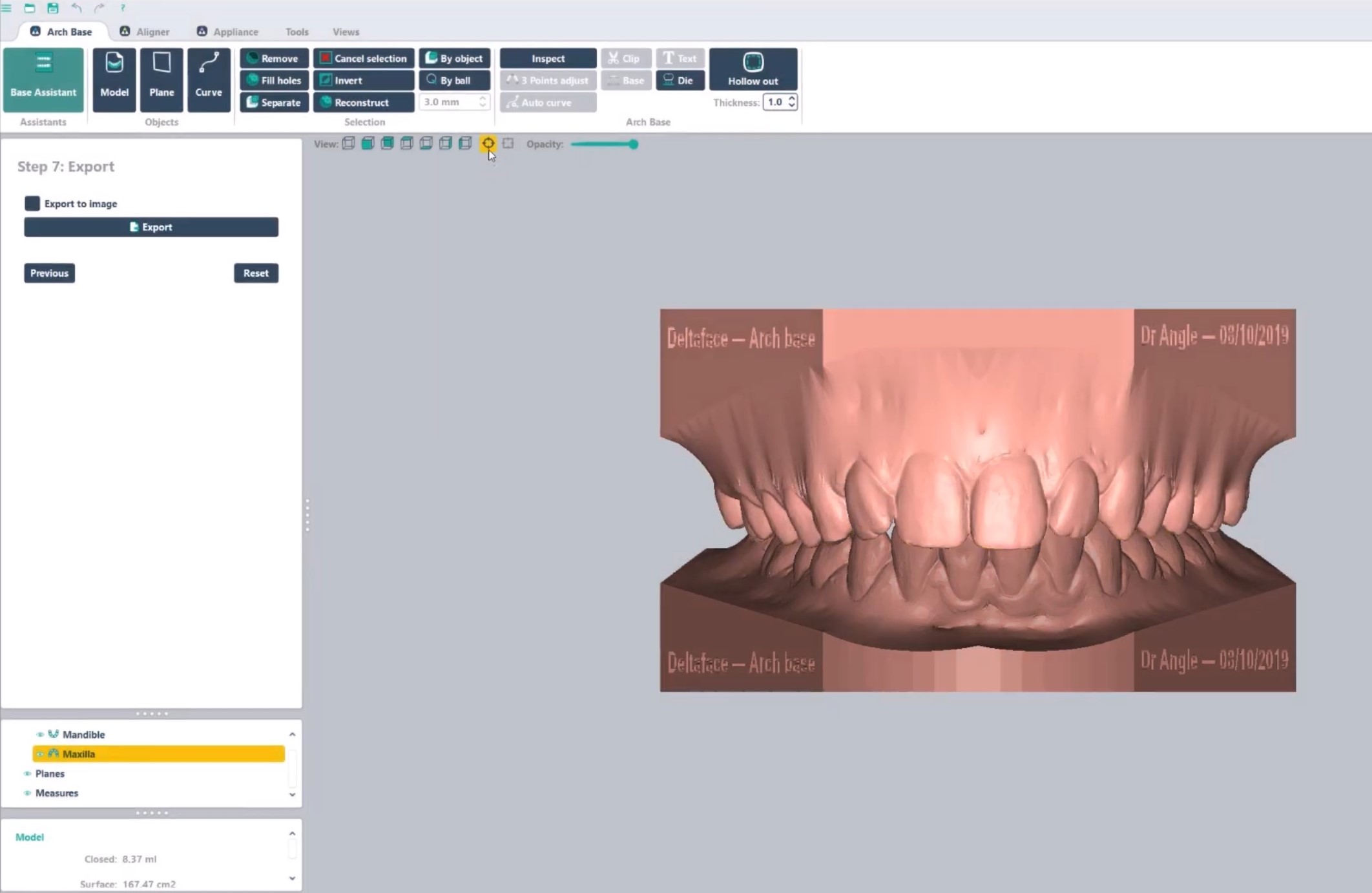 3D dental model creation Arch Base