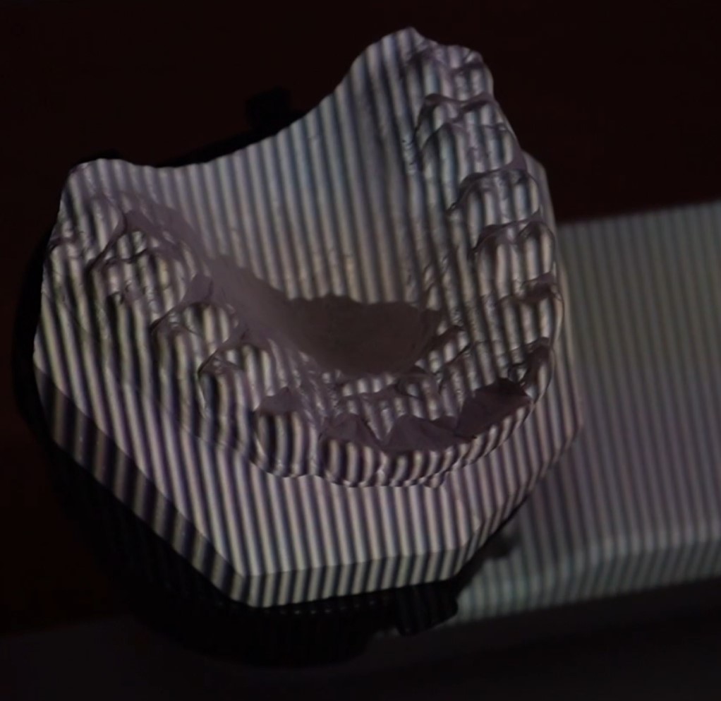 dental model scan