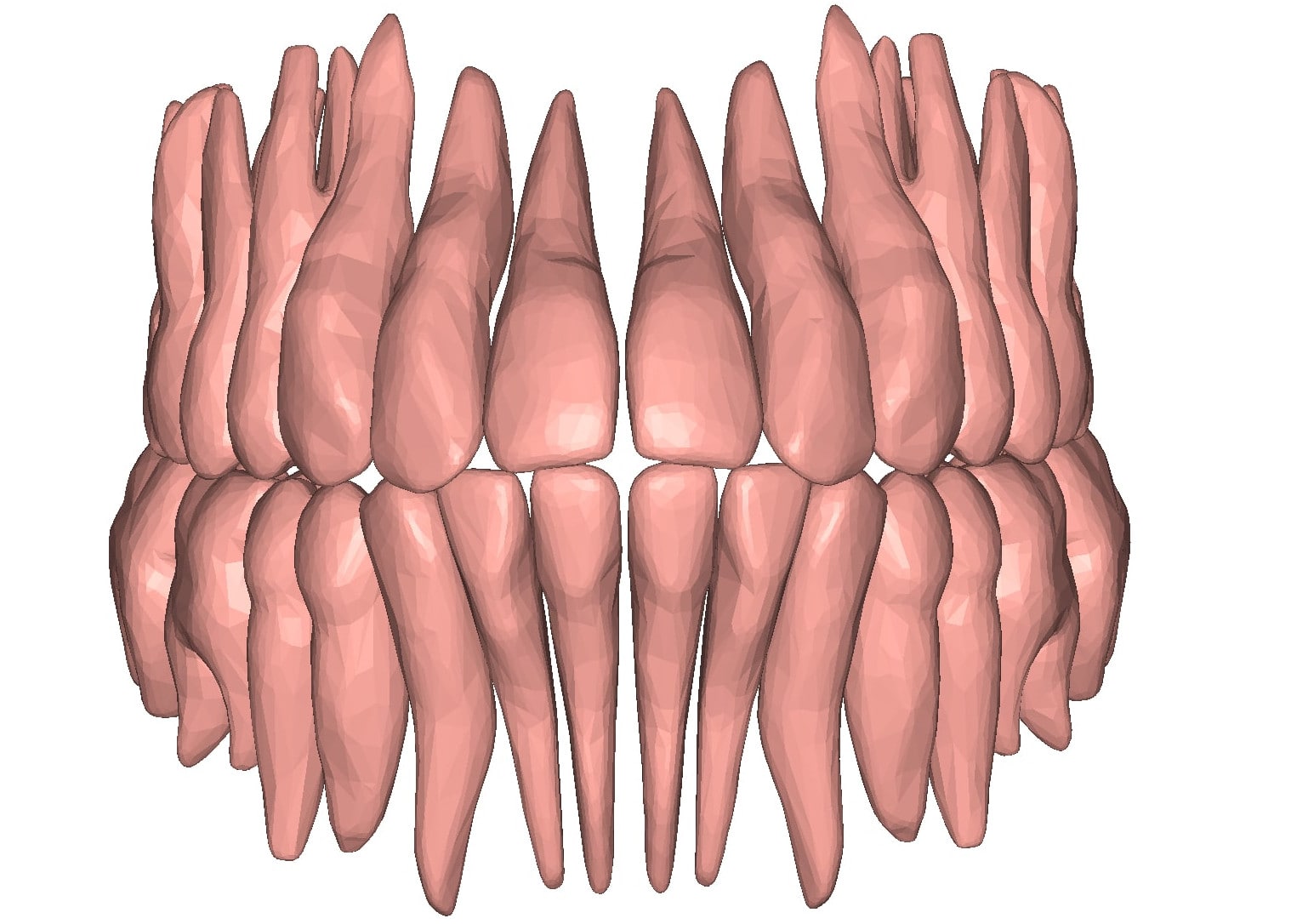 Appliance Pontic for tooth extraction 3D dental model DeltaFace