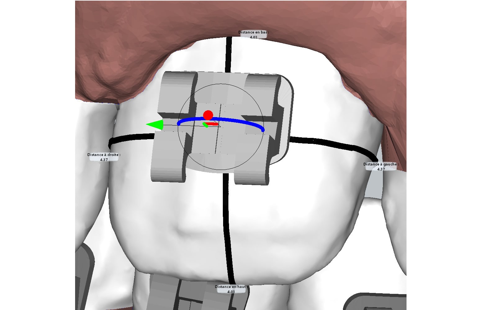 automatic brackets positioning