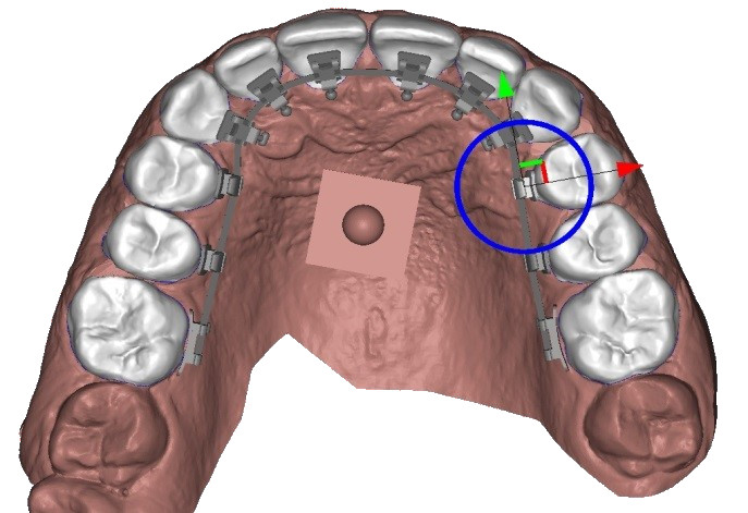 Placement of the brackets on archwire with manipulator for accurate 3D positioning of the brackets