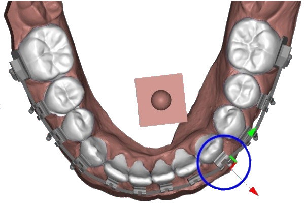 Automatic placement and three-dimensional positioning with manipulator