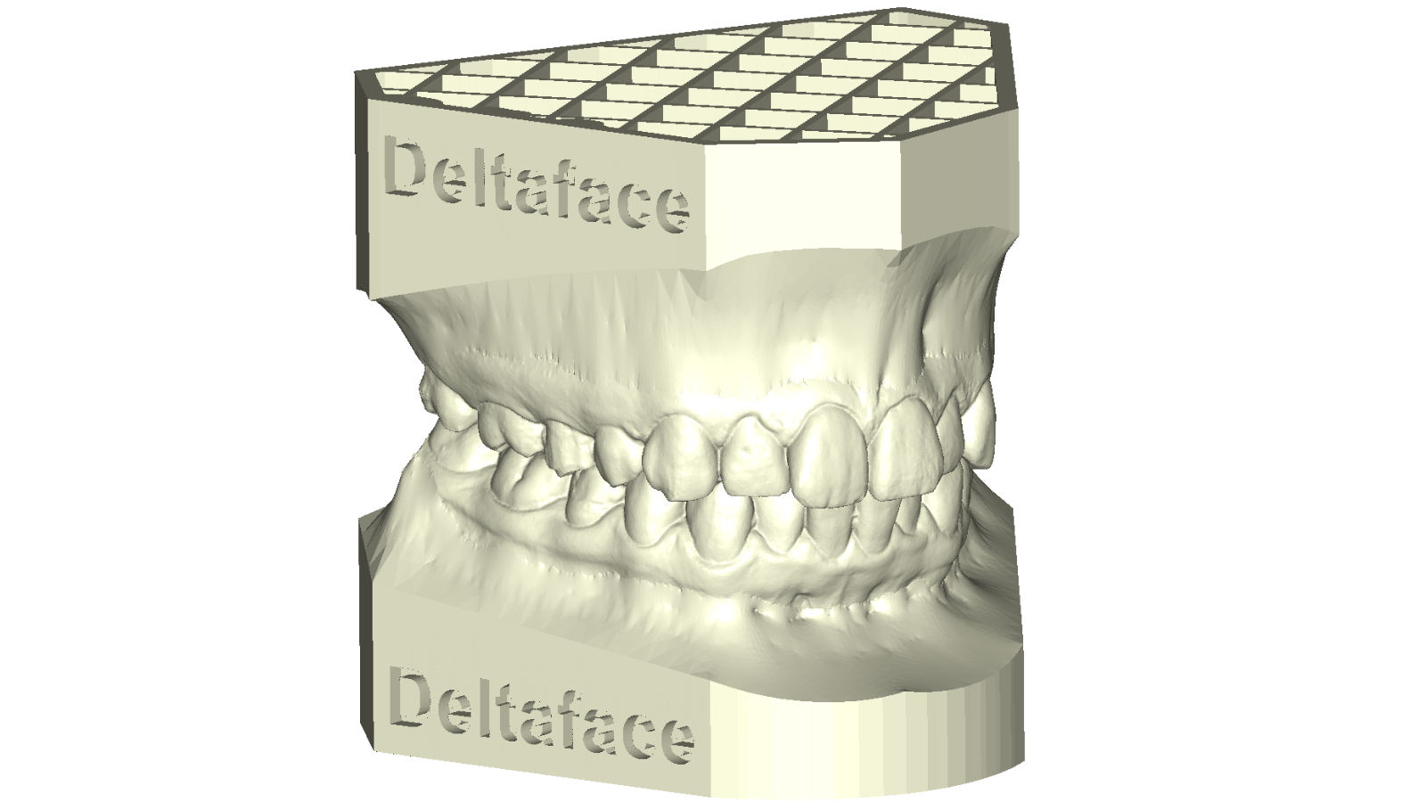 arch base: 3D orthodontic software solution for dental model creation DeltaFace