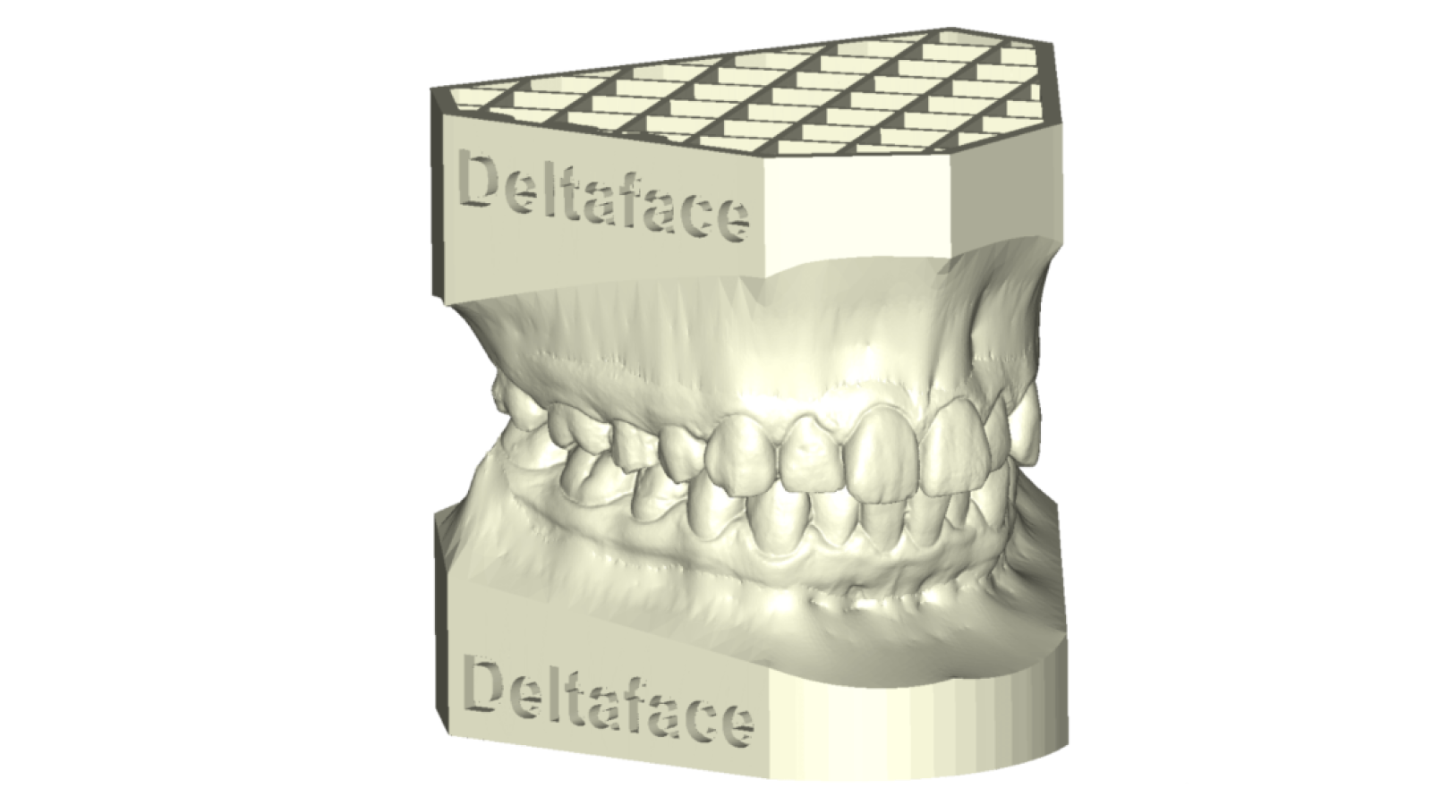 modèles dentaires 3D deltaface arch base