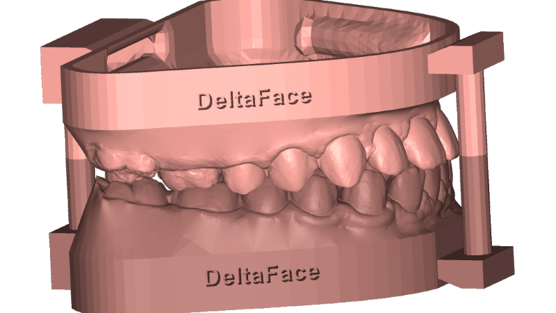 arch base: 3D orthodontic software solution for dental model creation DeltaFace